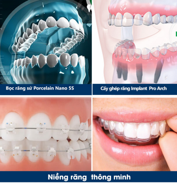 Các công nghệ thẩm mỹ nha khoa liên tục được cập nhật tại JW.